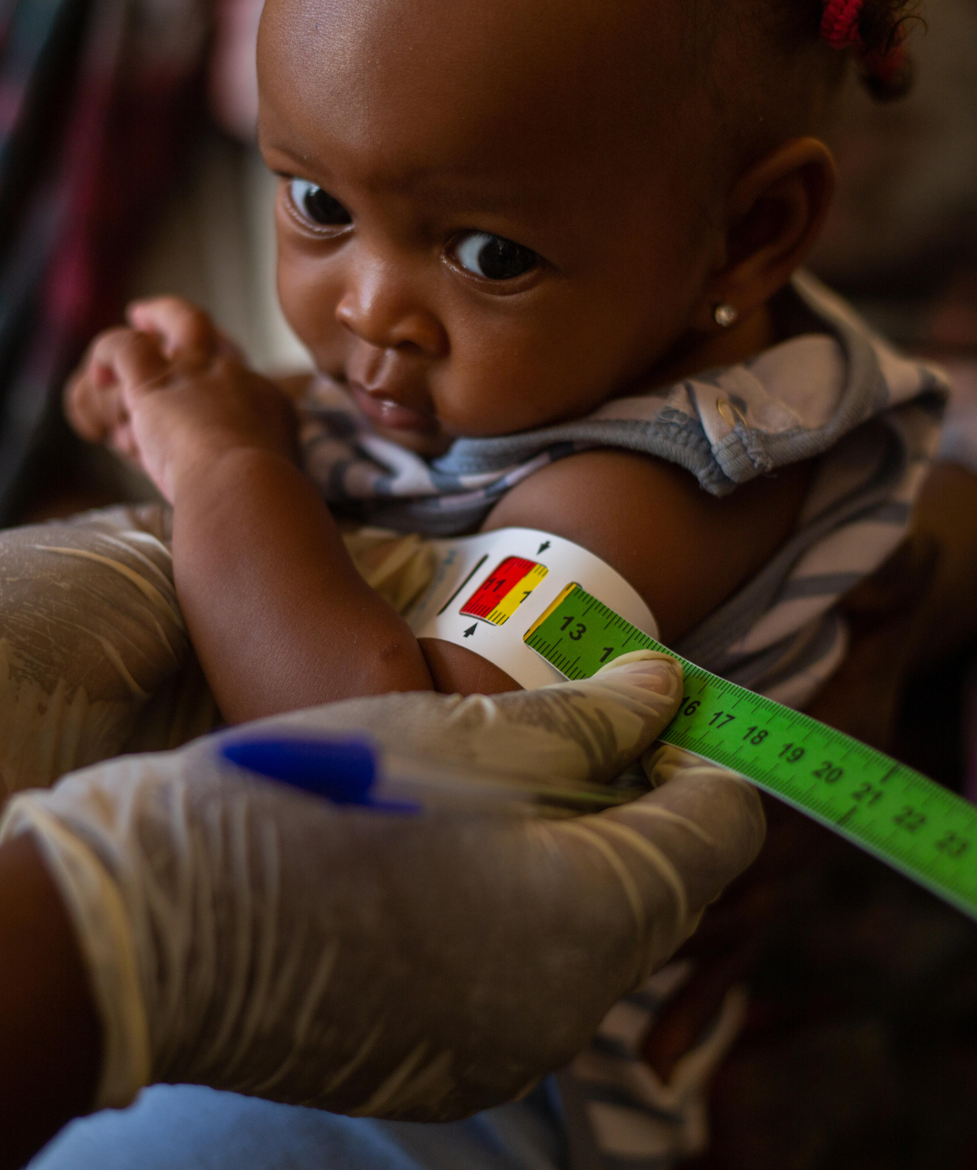 10 months old Amani Abdel Raouf is screened for malnutrition during an integrated health campaign conducted by the state Ministry of Health with UNICEF support in IDP gathering points in 8 localities of Gezira state.