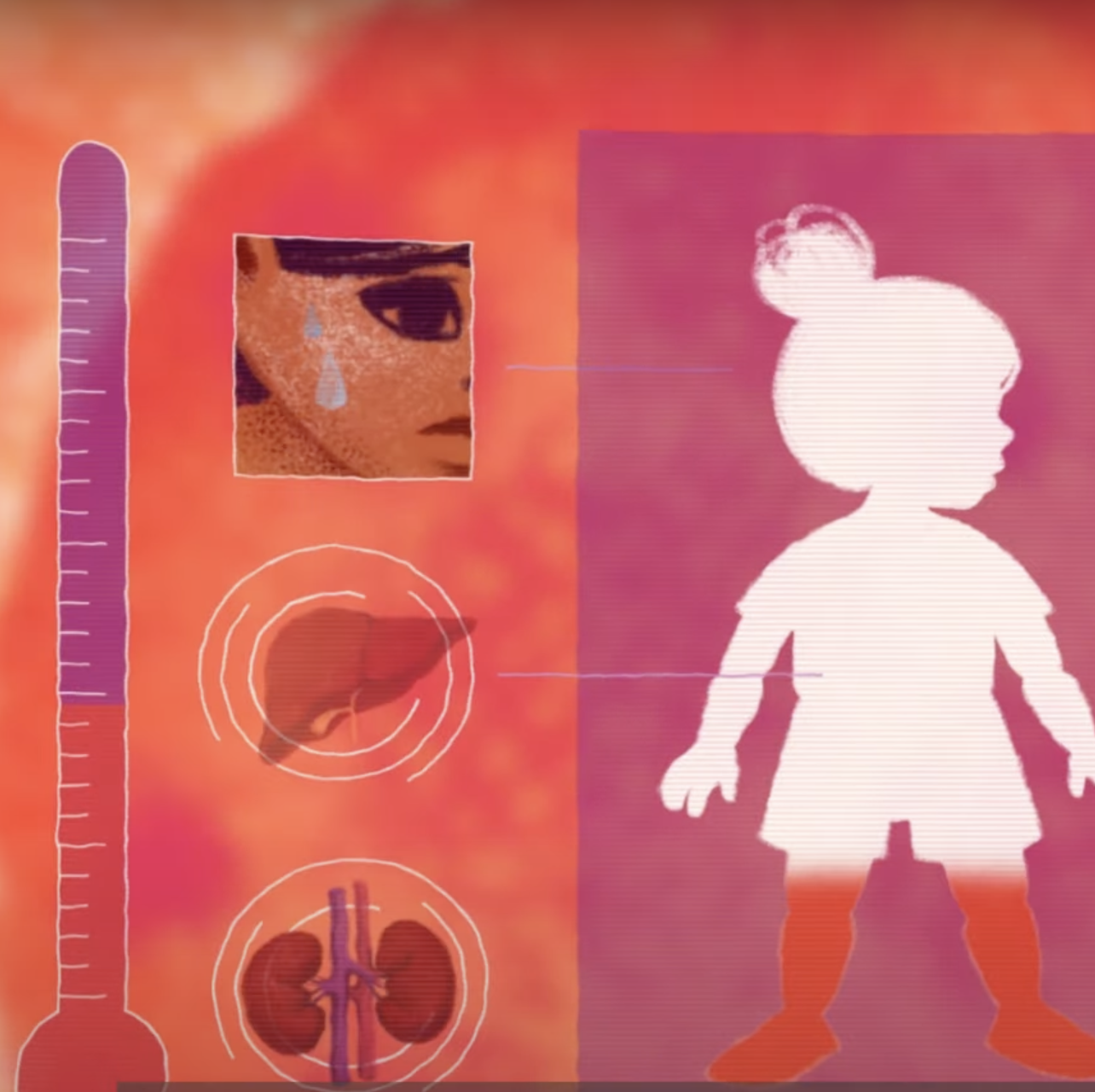 animation of child getting hot